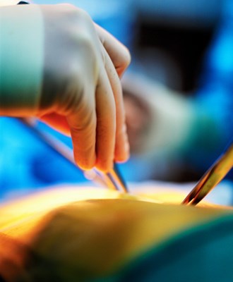 Image of a patient being checked for stomach cancer