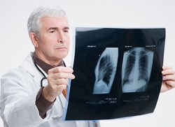 Image of a doctor viewing an xray of the lungs